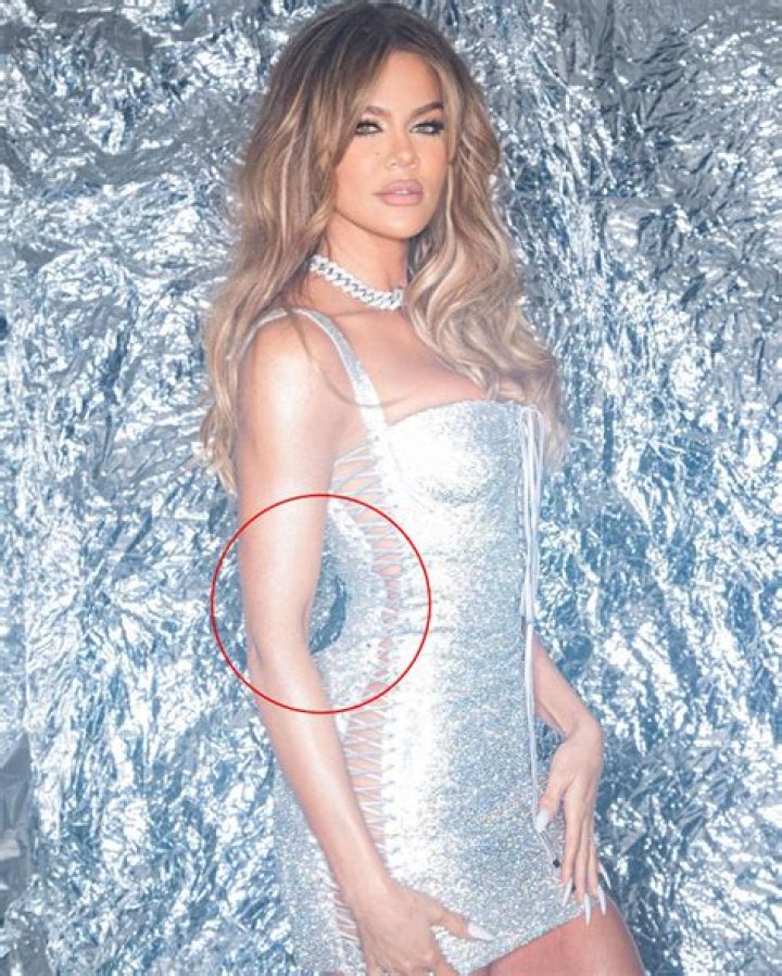 Khloe Kardashian Blasts Haters After Photoshopping Her Thighs: I Injured My Knee ‘A**holes’