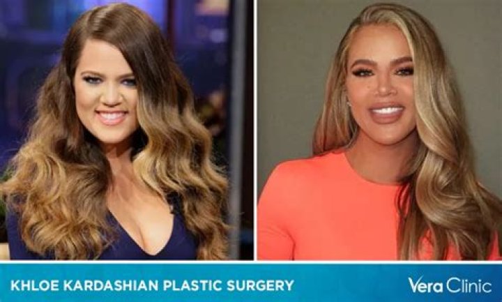 Khloe Kardashian: Plastic Surgeon Speaks On Appearance After Fans Think She Had A Nose Job