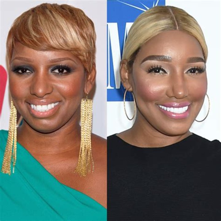 NeNe Leakes Spills Plastic Surgery Confessions On ‘Wendy Williams’ – Hollywood Life