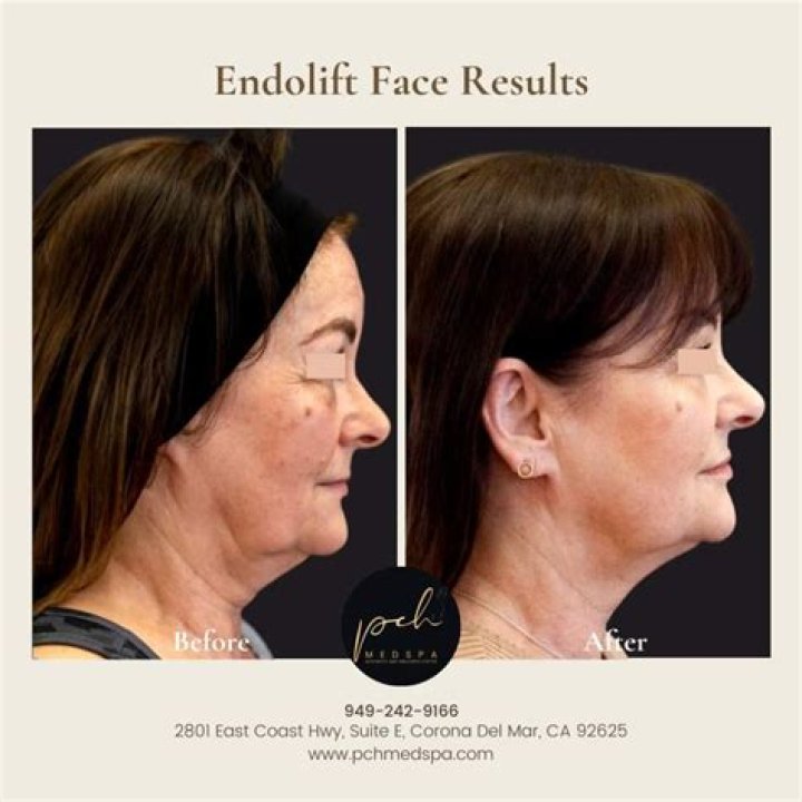 Over 14k People Swear By This $30 Anti-Aging Face Cream After Seeing Immediate Results