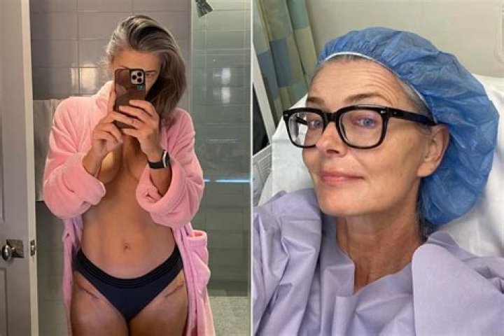 Paulina Porizkova Shows Off Her Scars From Hip Replacement Surgery in Bathroom Selfie: ‘Reminder of Old Pain’
