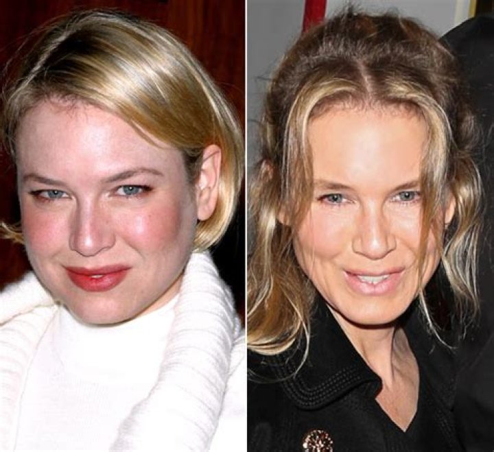 Plastic Surgery? — Different Look At ‘Long Shot’ Premiere – Hollywood Life