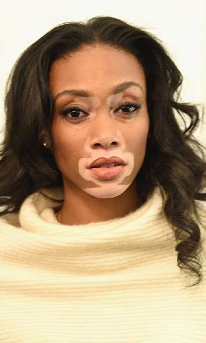 Winnie Harlow Celebrity Profile – Hollywood Life